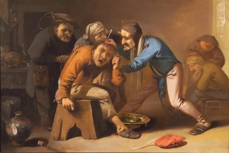 la trepanacion en la Historia